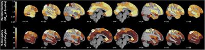 Human Cortical Serotonin 2A Receptor Occupancy by Psilocybin Measured Using [11C]MDL 100,907 Dynamic PET and a Resting-State fMRI-Based Brain Parcellation